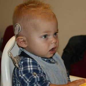 Nationale Cochlear Implantaat Dag Nationale Cochlear Implantaat Dag